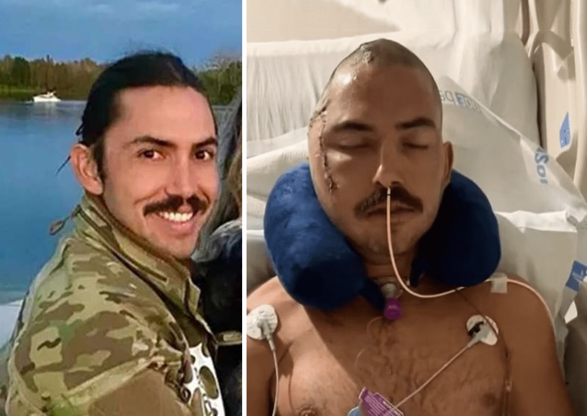 Hispano sobrevive al ataque de un caimán en Florida