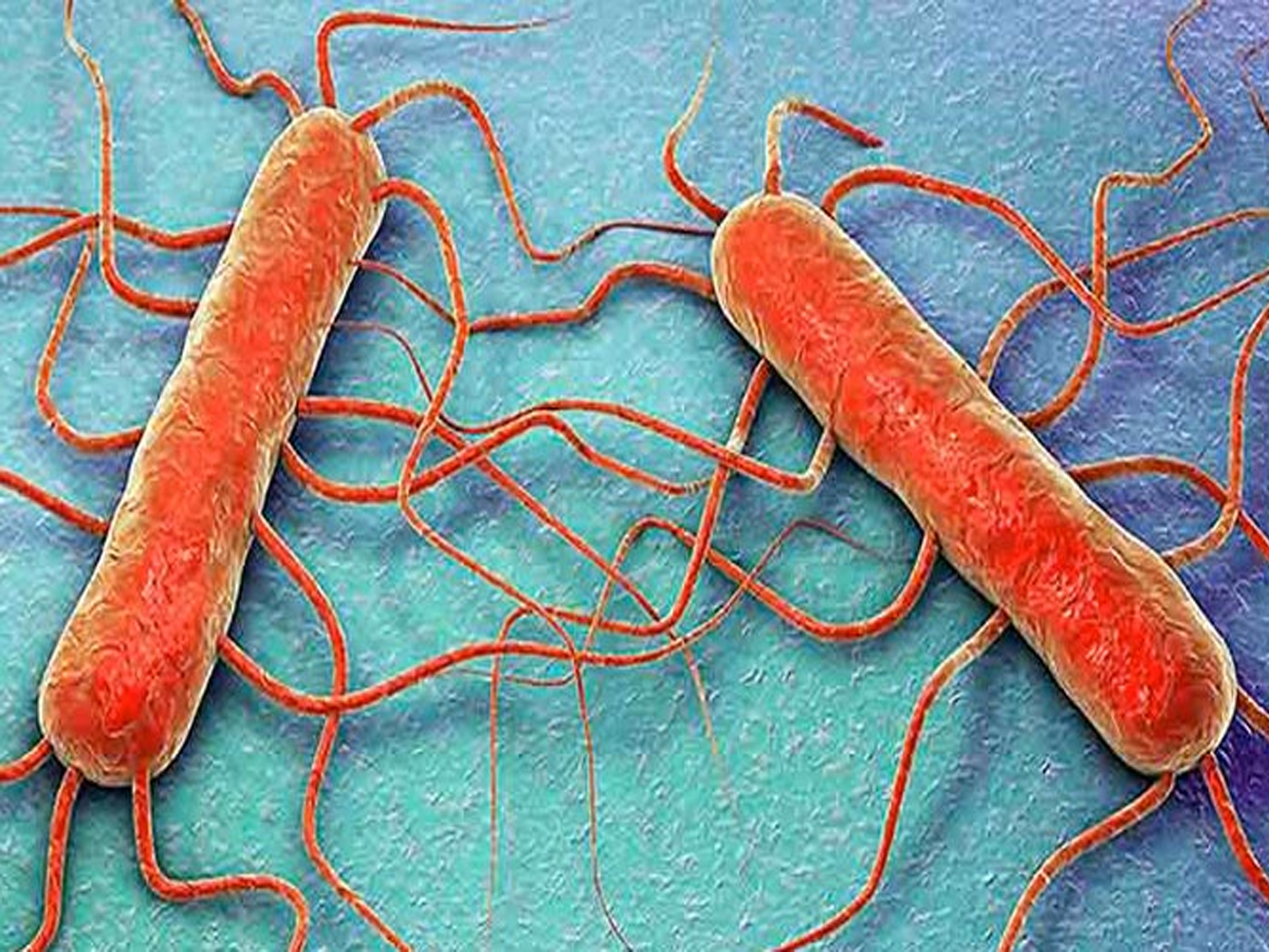 Retiran del mercado más de 400 productos debido a una posible contaminación con Listeria