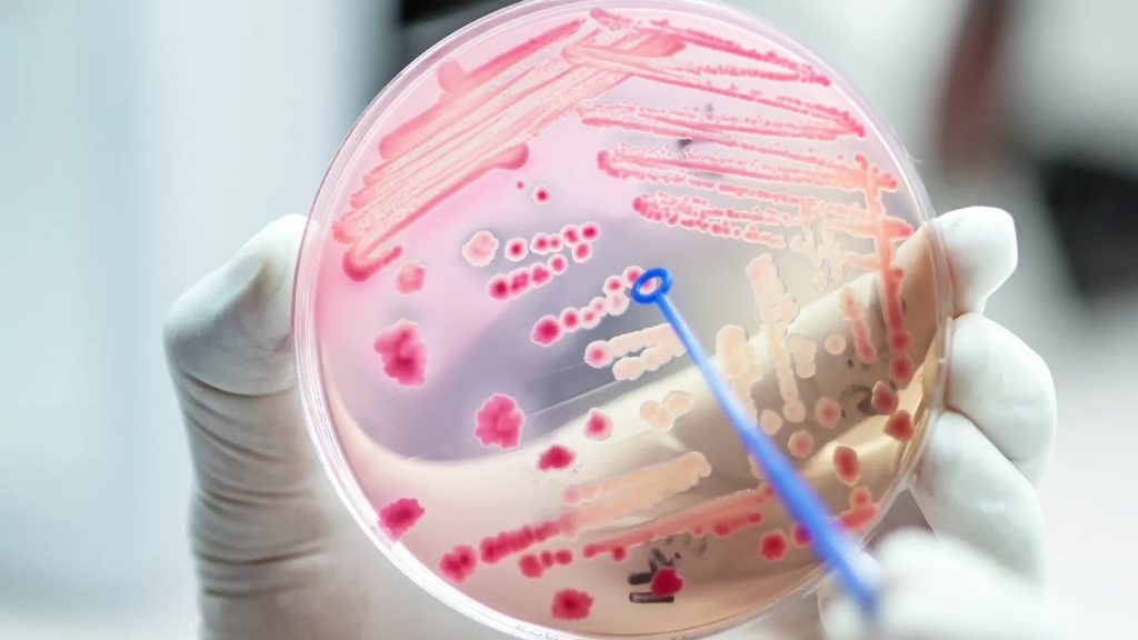 Aumentan los casos de infección por hongo conocido como Candida auris en Estados Unidos