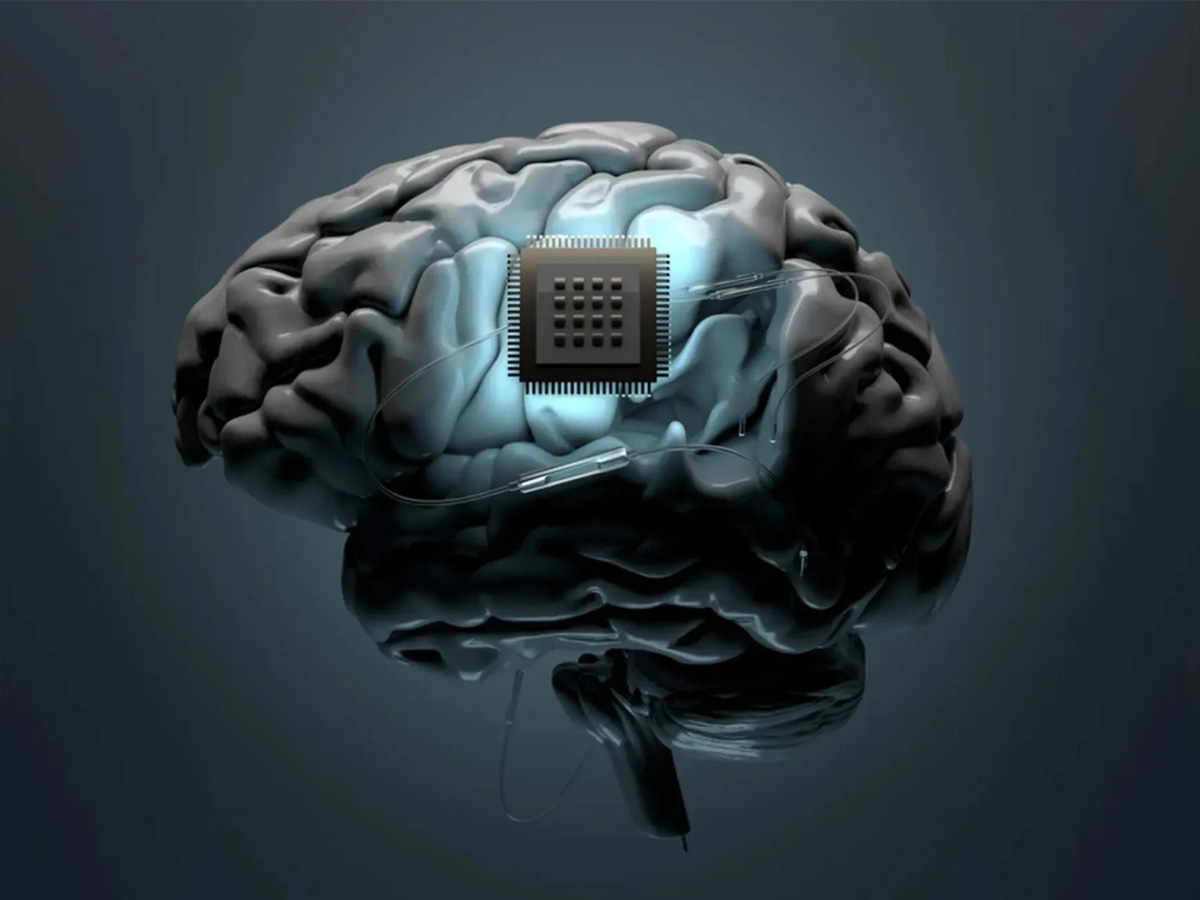 Aprueban los ensayos en humanos de los implantes cerebrales de Elon Musk