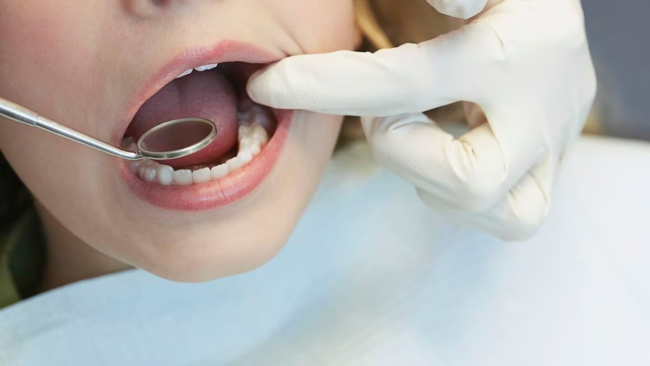 SERVICIO DENTAL GRATUITO!! Para niños de 4 a 18 años en FSCJ el 24 de febrero 2024