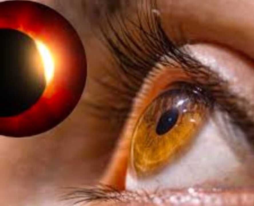 PUEDE EL ECLIPSE AFECTAR TUS OJOS? PUEDE EL ECLIPSE AFECTAR TUS OJOS?