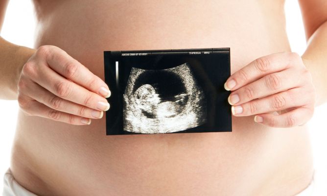 Entra en vigor en Florida la ley que prohíbe el aborto tras la sexta semana Entra en vigor en Florida la ley que prohíbe el aborto tras la sexta semana