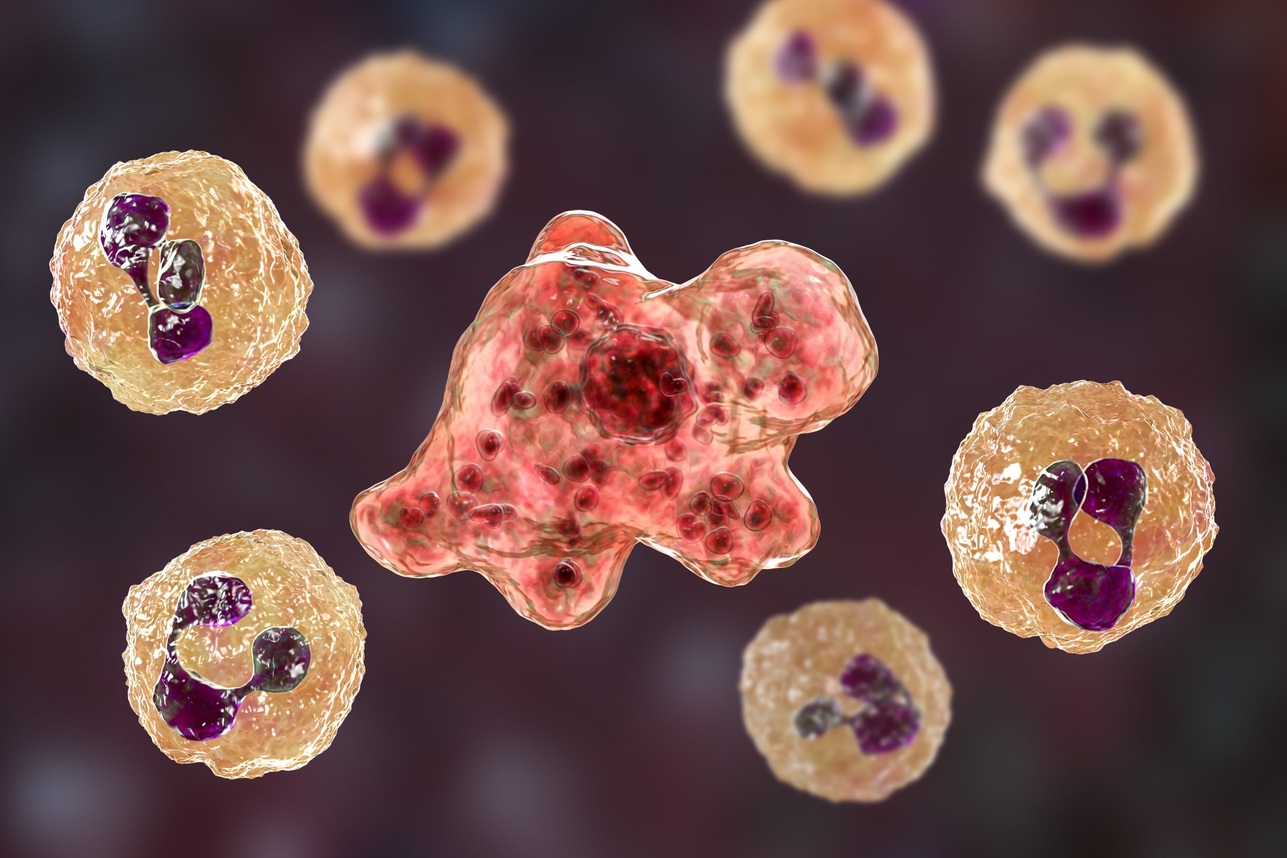 ALERTA SANITARIA EN FLORIDA: CONFIRMAN LA PRIMERA MUERTE POR BACTERIA ‘COMECARNE’ DE 2026